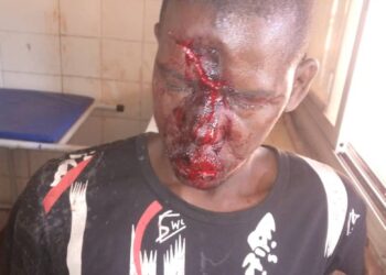 Affrontement entre des habitants de 2 villages à Dinguiraye : Voici quelques images des blessés !!!