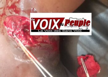 Circulation/Siguiri : Un conducteur de taxi-moto égorgé par son client !!!