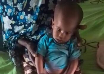 SOS pour Oumou Hawa BARRY, une fillette de 2 ans gravement malade !!!