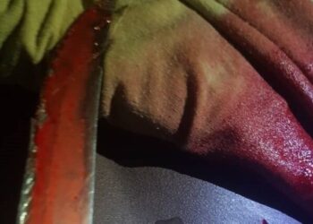 Siguire/Norassoba : Mballou Kallé poignarde son fiancé, et ce dernier succombe !!!