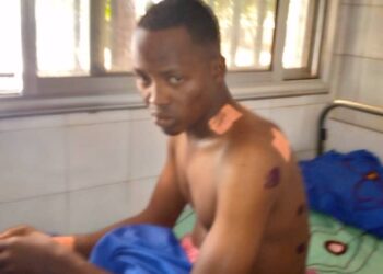 Insécurité à Dinguiraye : Attaqué par des bandits, un conducteur de taxi moto échappe à la mort!!!