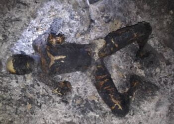 Les images des enfants brulés dans l’incendie à Macenta sont insoutenables (images) !!!