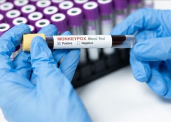 Le Maroc enregistre un premier cas de Mpox!!!