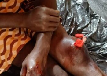 Siguiri : Deux hommes grièvement blessés dans une attaque armée en plein jour