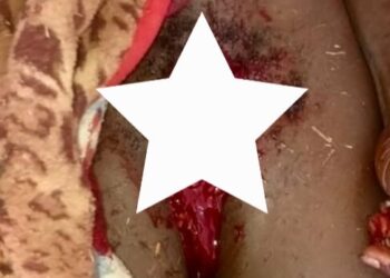 Siguiri: Un homme coupe ses organes génitaux