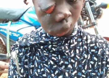 Tumeur menaçante : Aïssatou, 9 ans, privée d’école et d’enfance