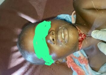 Siguiri : Un enfant de 4 ans égorgé, sauvé in extremis à l’hôpital préfectoral