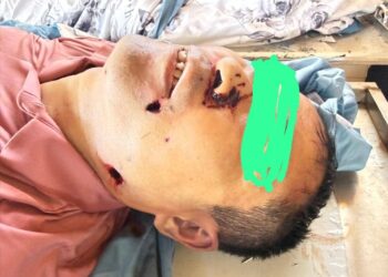 Doko–Siguirí : une embuscade meurtrière relance les inquiétudes sécuritaires