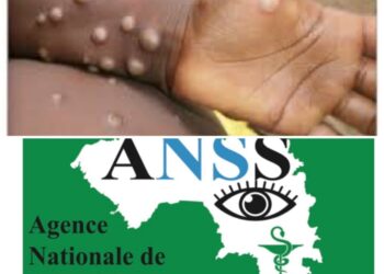 Santé : plusieurs maladies surveillées en Guinée dont le Mpox (ANSS)